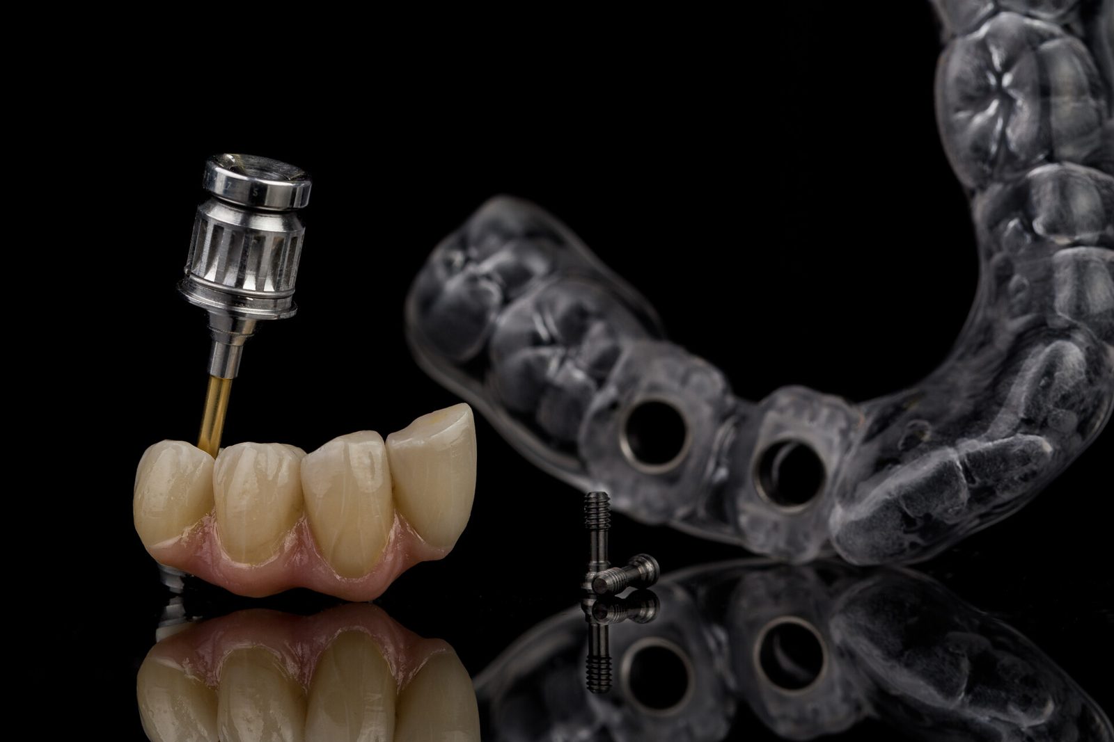 Implant Restorations