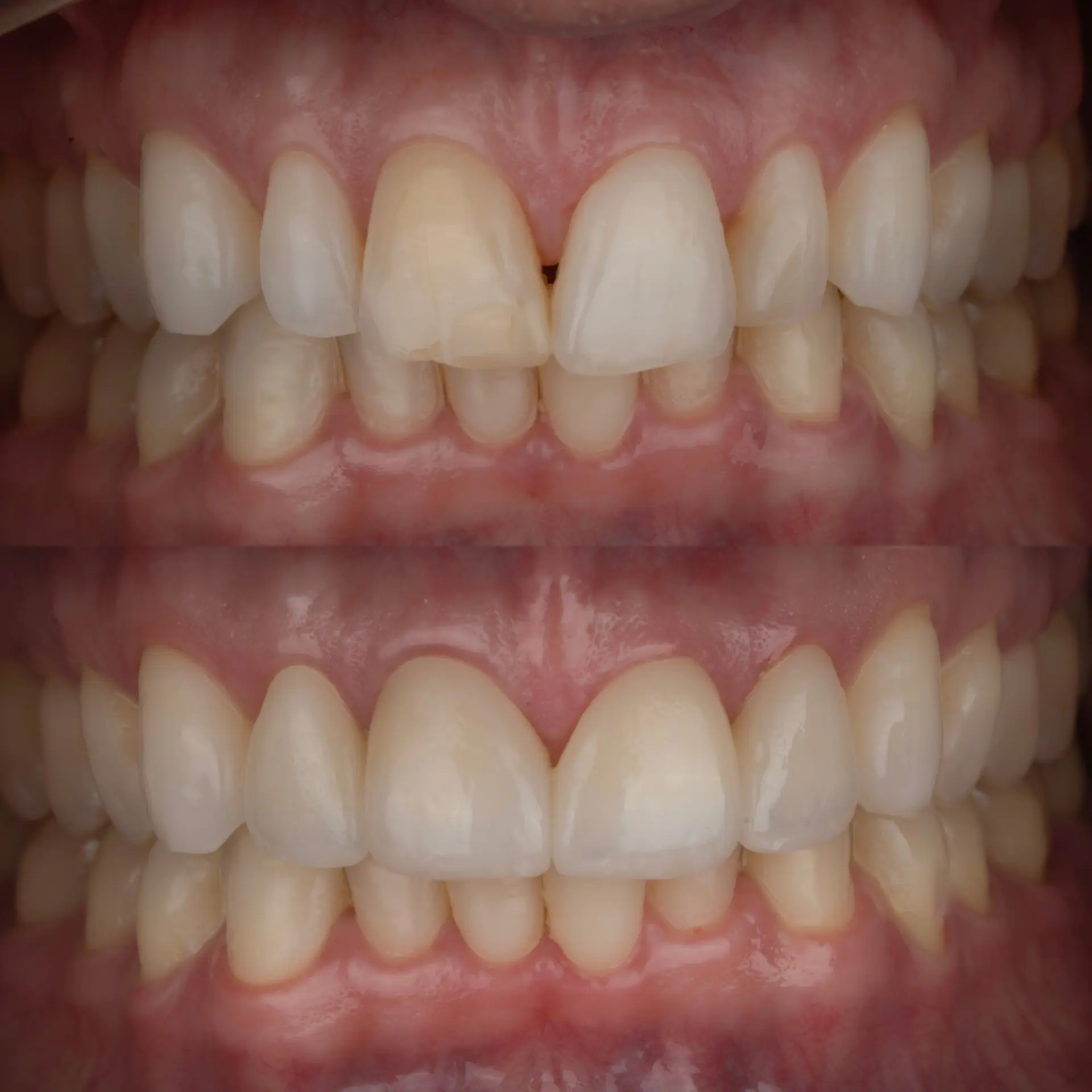 Before and after dental transformation