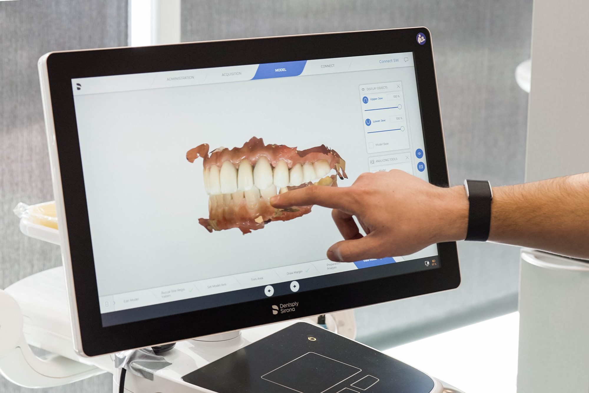 A Restorative Dentistry Group team member pointing to a 3D digital scan of a patient's teeth on a treatment-planning screen