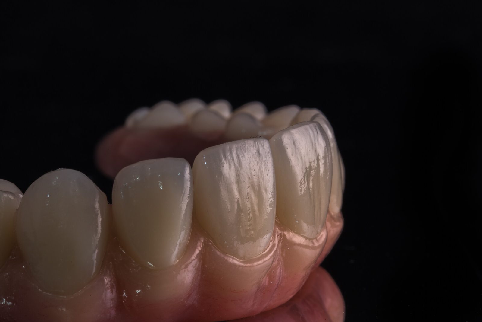 Anterior Aesthetics