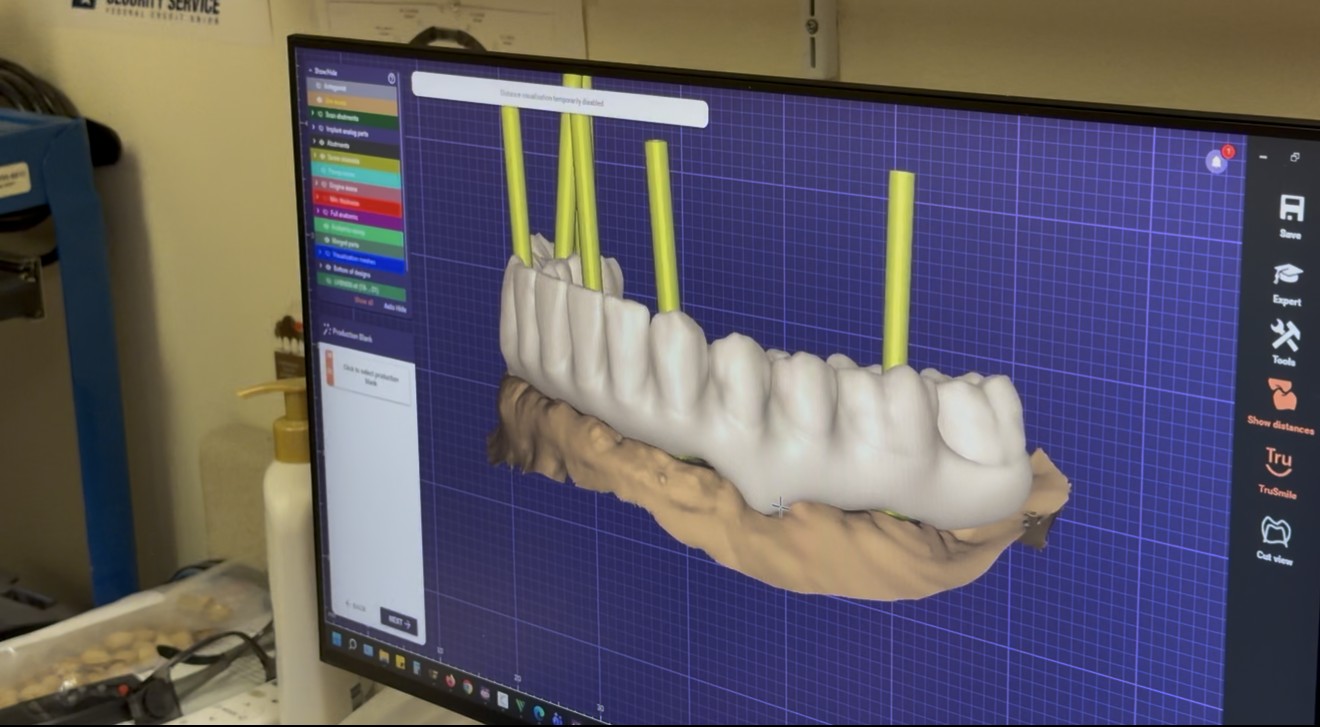 CAD/CAM Technology