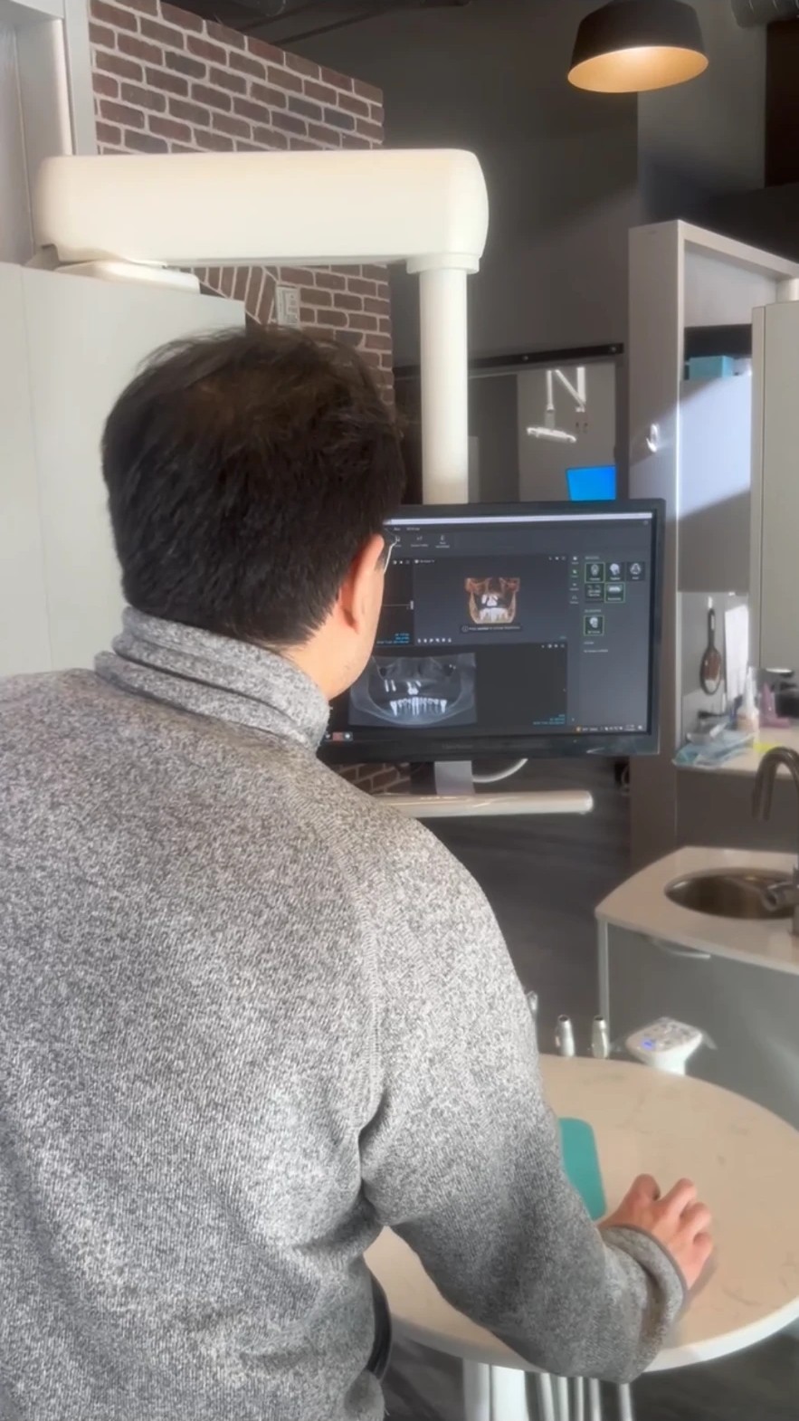 CBCT / Cone Beam Scanning